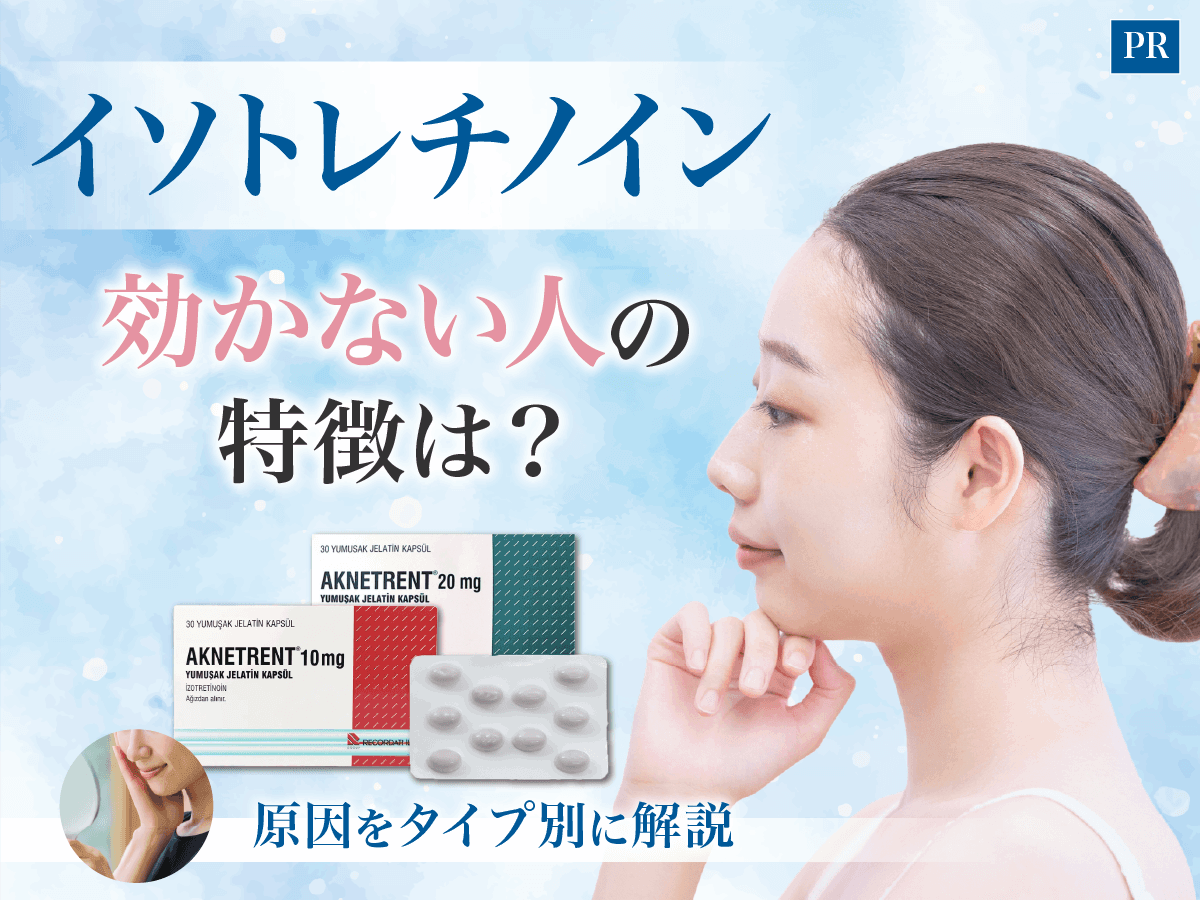 イソトレチノインが効かない人の特徴は?イソトレチノインが効かないと感じる理由や原因を分かりやすく解説
