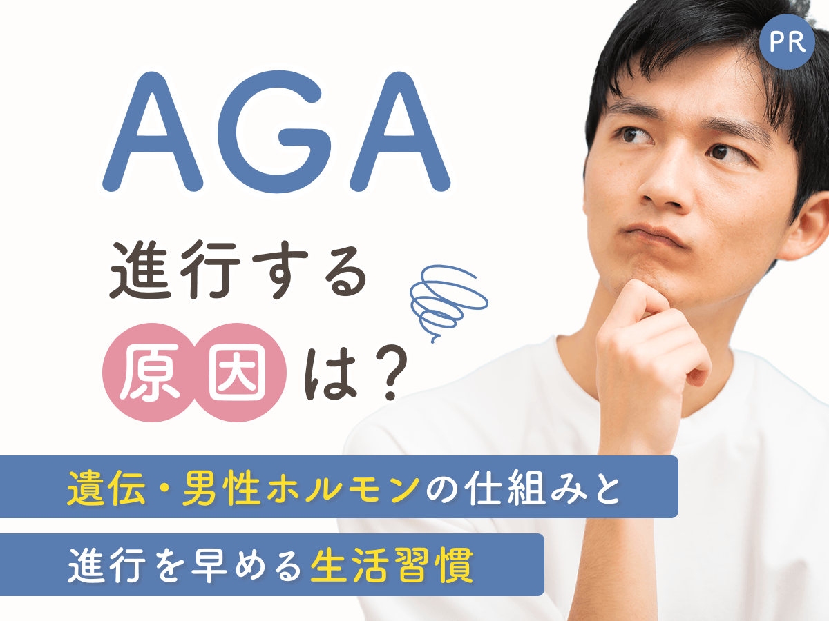 AGAの原因は？遺伝・男性ホルモンの仕組みと進行を早める生活習慣を徹底解説