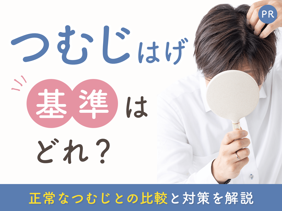 つむじハゲの基準とは？正常なつむじとの違い・見分け方5つ・確認方法と治療
