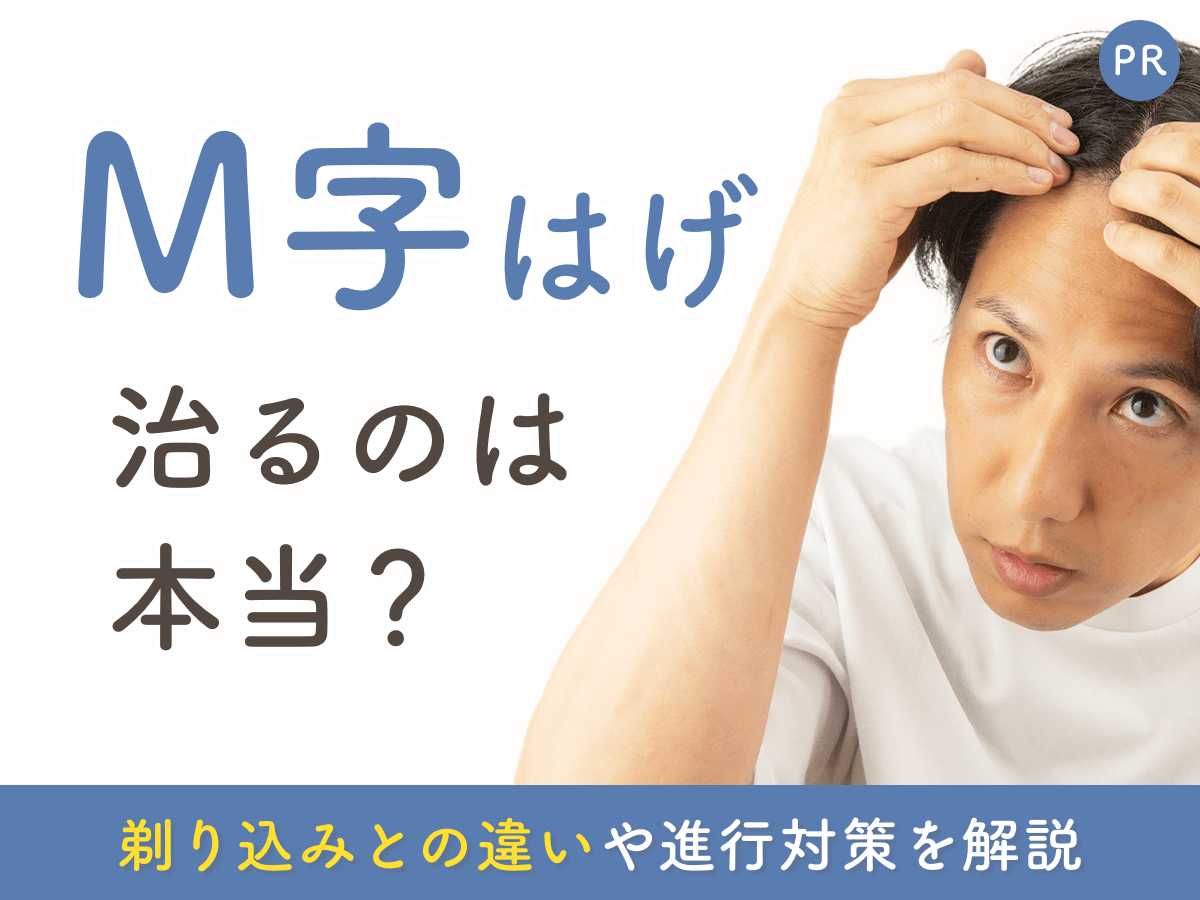 M字ハゲは治る？剃り込みとの違い・進行の見分け方・治療で改善が期待できる条件