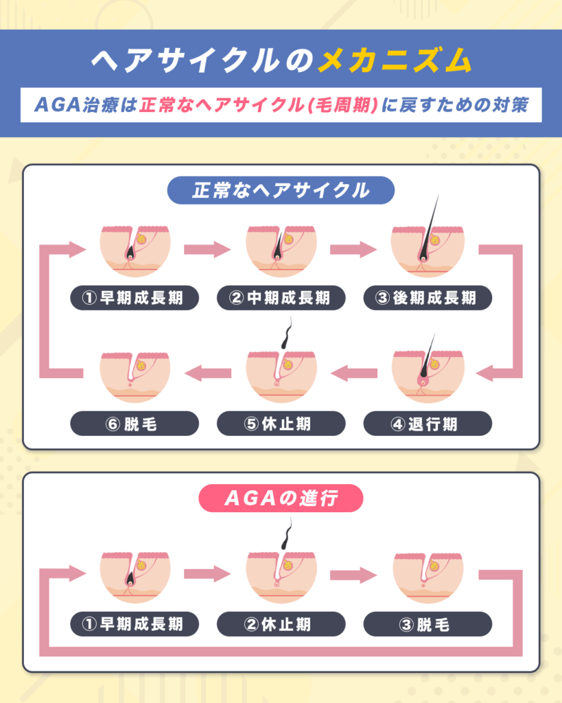 AGA治療でポイントになるヘアサイクルのメカニズム