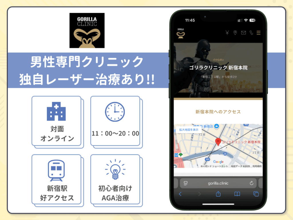 ゴリラクリニック新宿本院はFolixレーザーの取り扱いで頭皮の悩みを解消しやすい